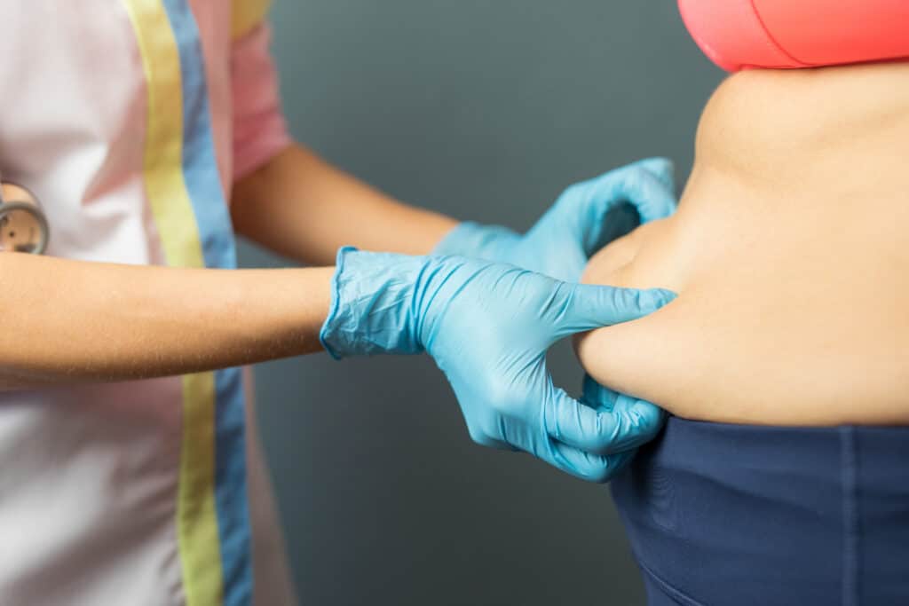 Doctor inspecting patient's tummy fat